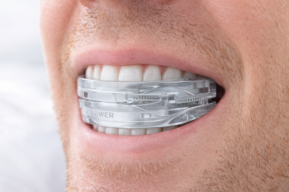QuietNight Anti-Snoring Mouth Guard